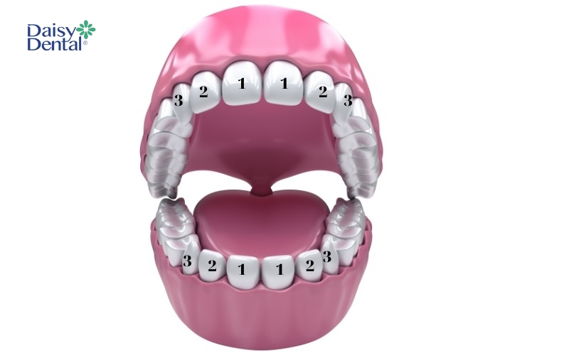 Răng cửa lớn là cột mốc cho mỗi phần cung hàm nhỏ