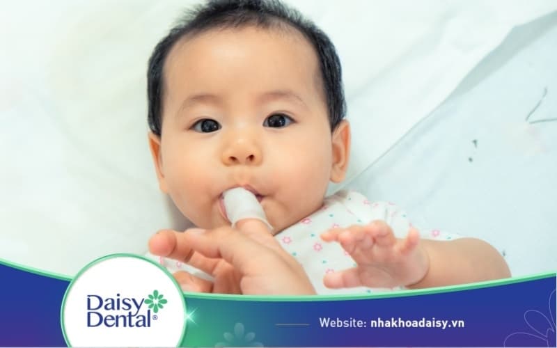 Rơ lưỡi cho trẻ sơ sinh