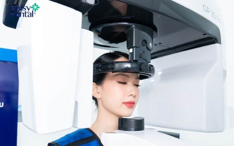 Công nghệ chẩn đoán hình ảnh CT KaVo OP 3D Pro cho hình ảnh sắc nét