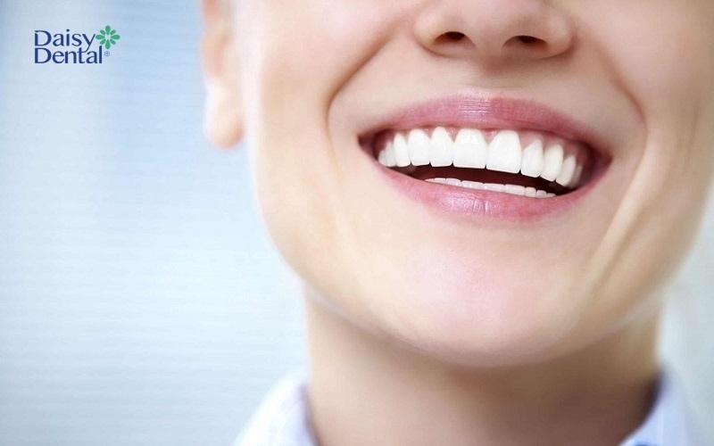 Răng Cercon có màu sắc tự nhiên và khả năng ăn nhai tốt