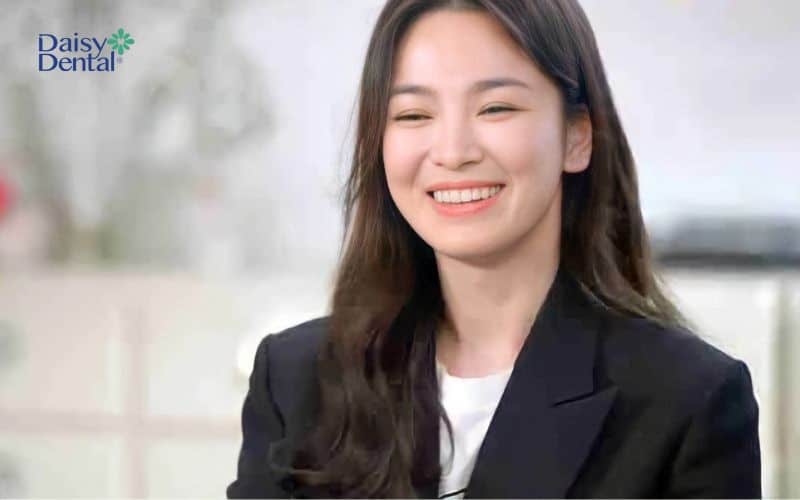 Song Hye Kyo được mệnh danh là nữ diễn viên sở hữu “nhan sắc trẻ mãi không già”