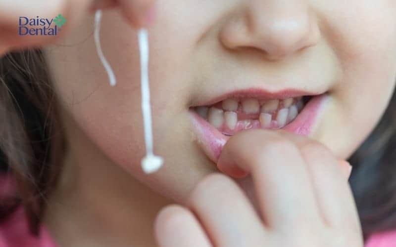 Sử dụng chỉ nha khoa để làm răng sữa rụng