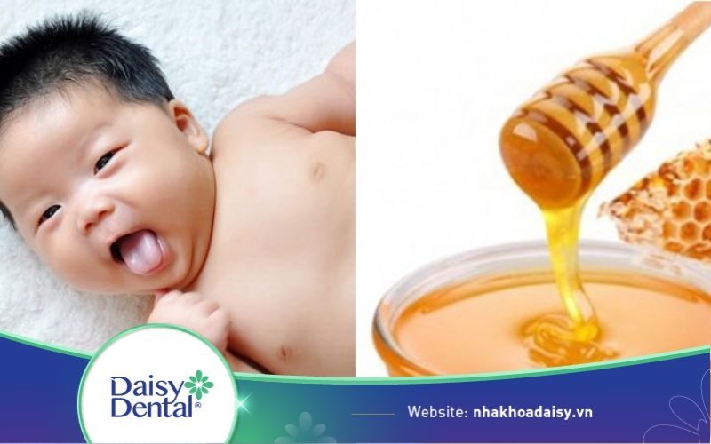 rơ lưỡi cho trẻ sơ sinh bằng mật ong