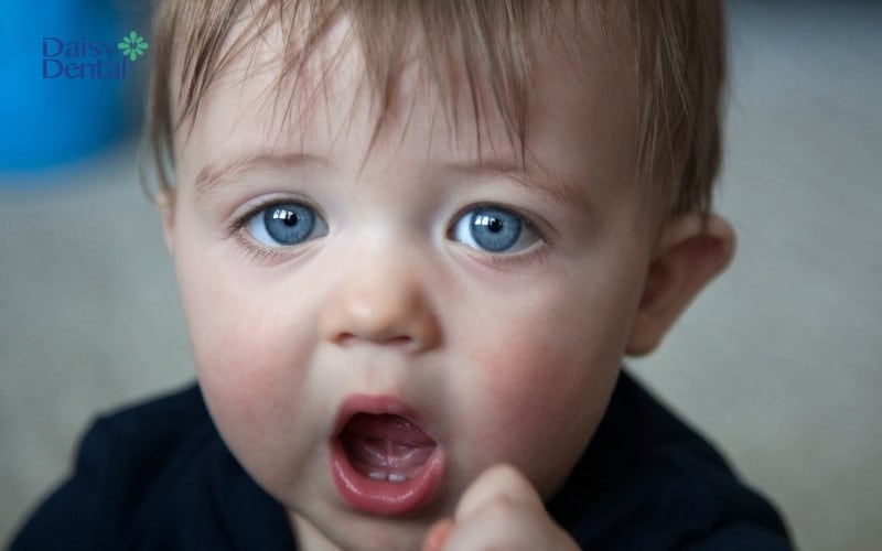 Má ửng hồng có thể là dấu hiệu mọc răng ở trẻ