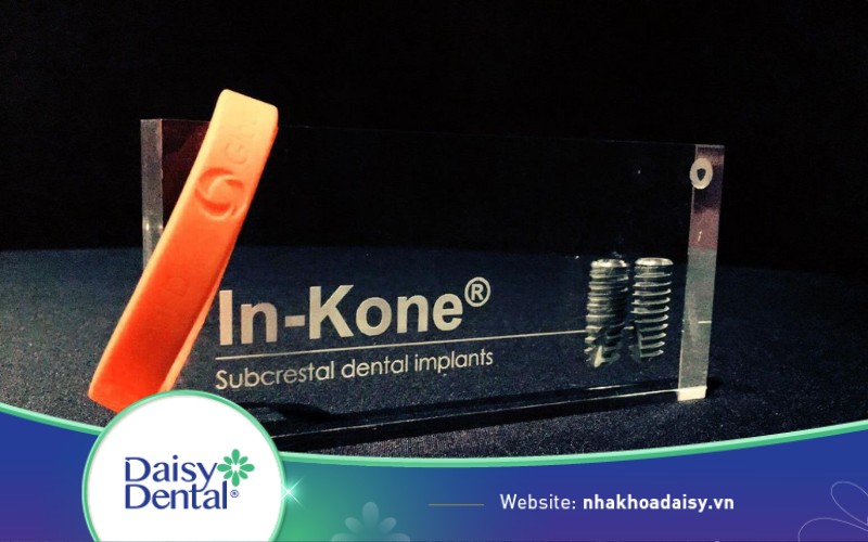 Nha khoa Quốc tế DAISY chính thức ra mắt dòng trụ Implant Tekka In - Kone của Global D (Pháp)