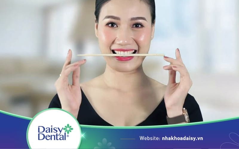 Ngậm đũa chữa mặt lệch