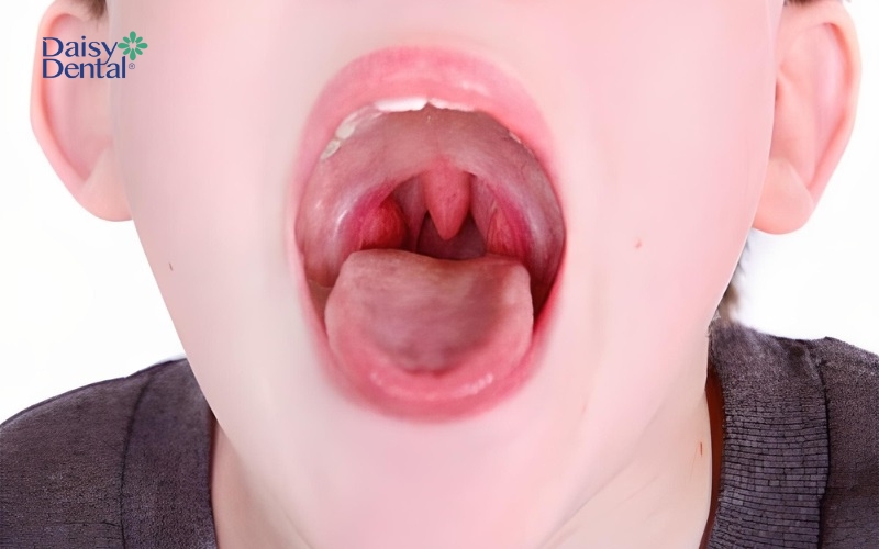 Khoang miệng khỏe mạnh của bé có màu hồng phấn