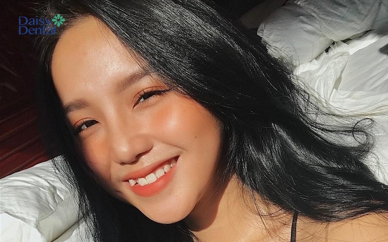 Linh Kiu được cư dân mạng gọi là "hot girl răng khểnh"