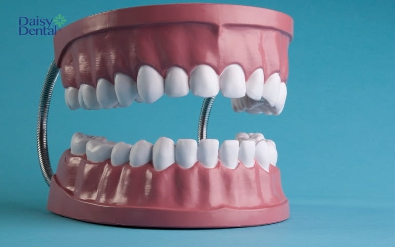 Bộ răng vĩnh viễn ở người trưởng thành thường sẽ có khoảng 28 - 32 chiếc răng