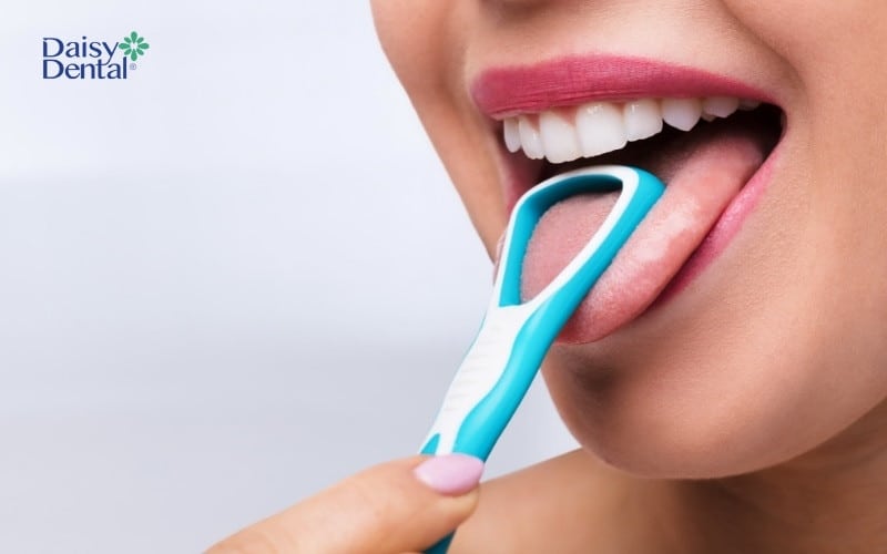 Dùng dụng cụ cạo lưỡi để lưỡi luôn sạch sẽ, ngăn chặn các bệnh lý liên quan đến lưỡi