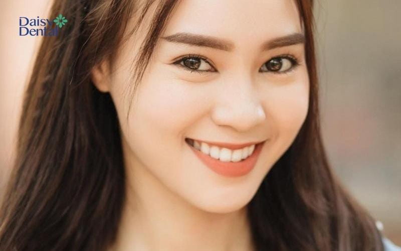Nữ diễn viên Lan Ngọc nổi bật với nụ cười thu hút, quyến rũ