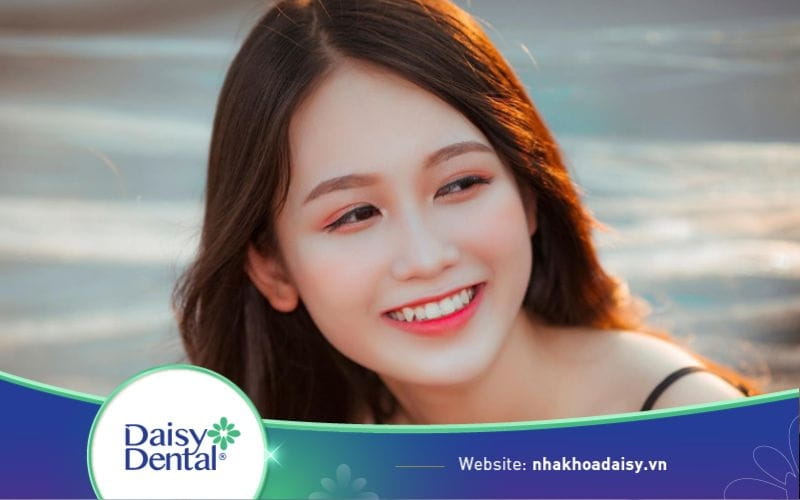 Đắp răng khểnh giữ được bao lâu