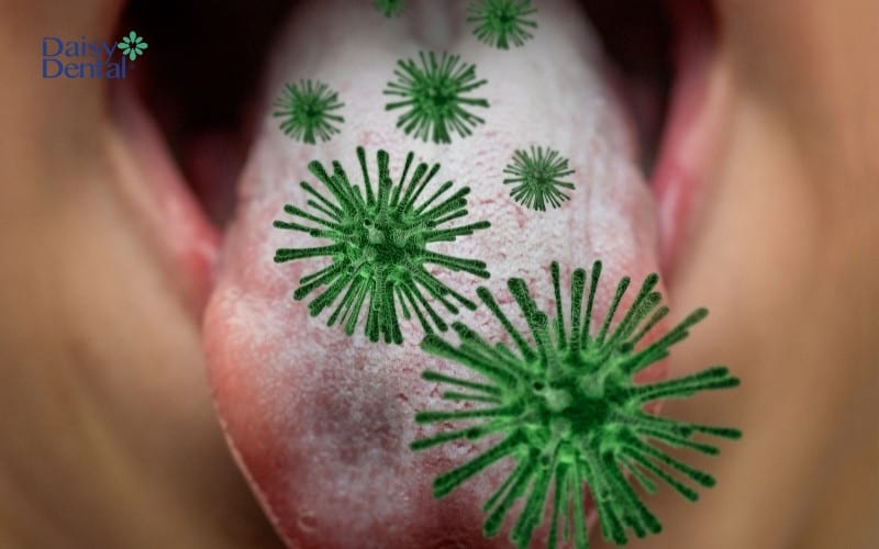 Tưa lưỡi hình thành do vi khuẩn hoặc nấm tích tụ, sinh sôi và phát triển