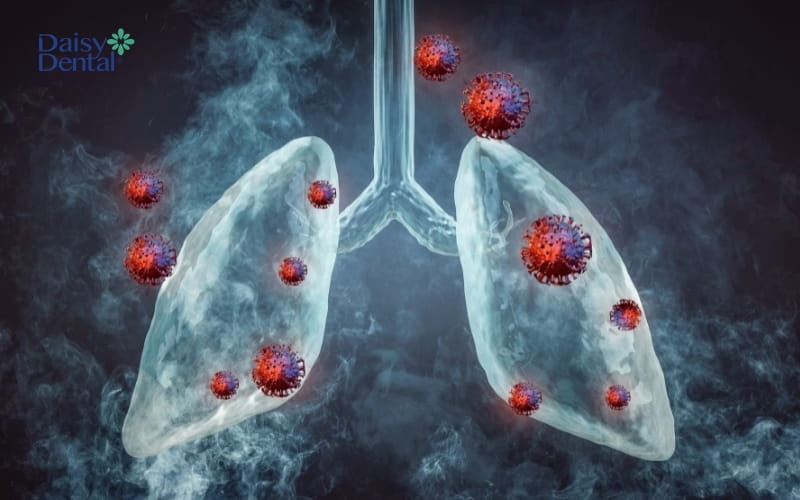 Ung thư phổi, các vấn đề về hô hấp có thể khiến khoang miệng ngòn ngọt