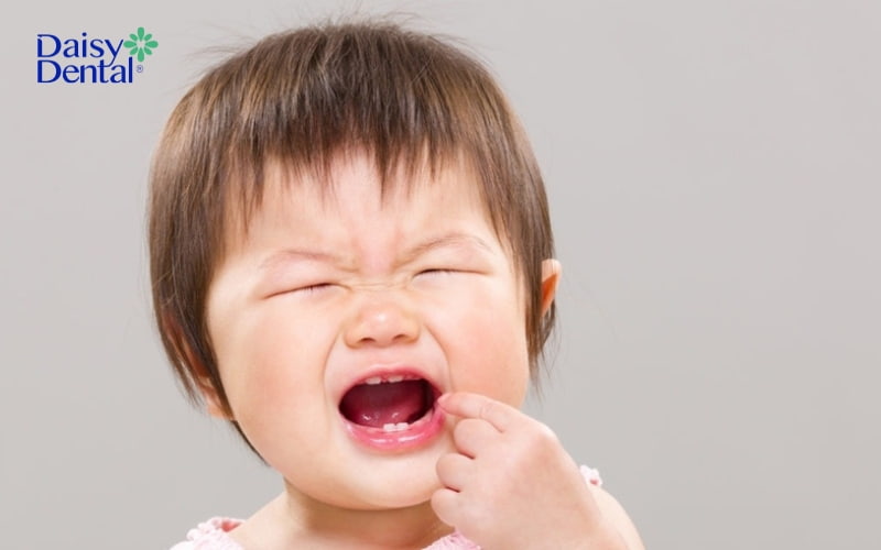 Viêm lợi ở trẻ em 2 tuổi do mọc răng