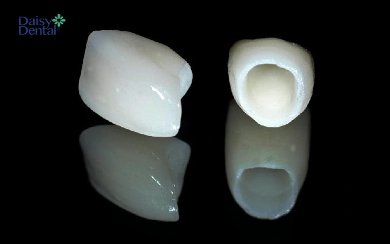 Quá trình làm răng sứ không đúng cách có thể khiến răng bị rớt