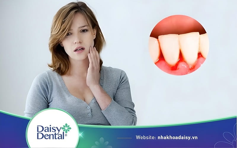 Bà bầu bị chảy máu chân răng