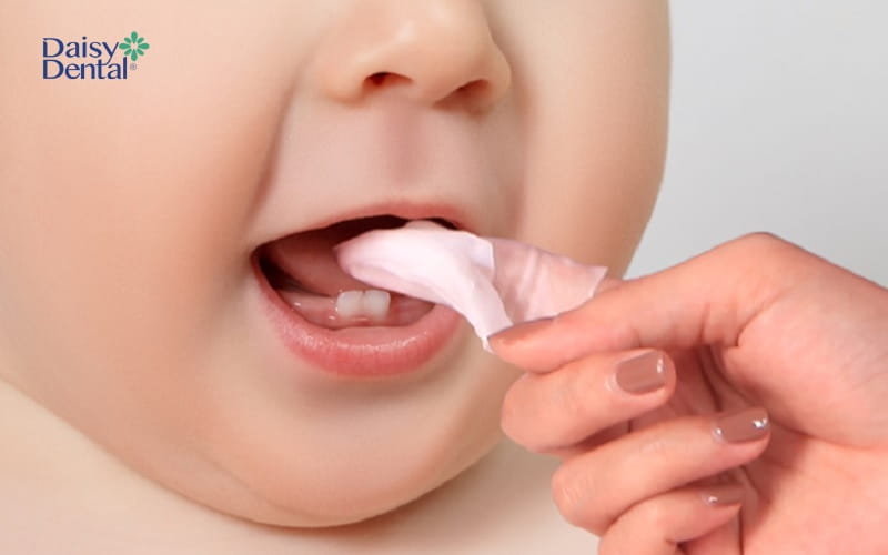 Bạn nên vệ sinh răng cho bé nhằm tránh tình trạng nhiễm trùng trong thời gian này