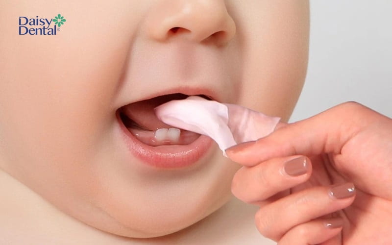 Giúp bé vệ sinh răng miệng đúng cách để cải thiện tình trạng nấm miệng
