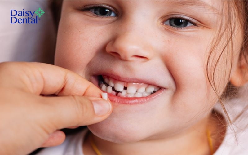 Quá trình thay răng của trẻ thường bắt đầu từ năm 6 tuổi