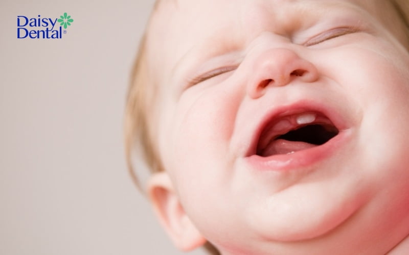 Răng hàm trên mọc trước không gây ra ảnh hưởng xấu nào đến sức khỏe của con