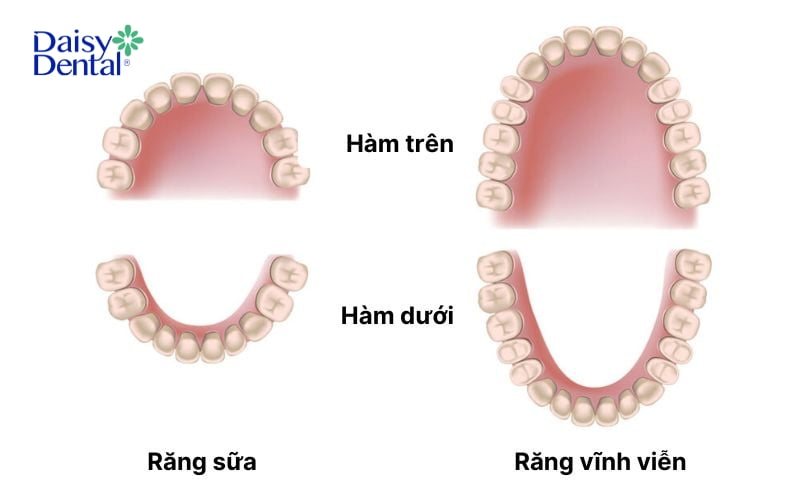 Răng sữa và răng vĩnh viễn có nhiều đặc điểm khác nhau