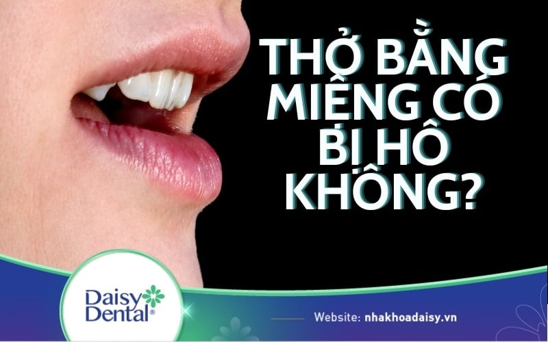 Thở bằng miệng có bị hô không