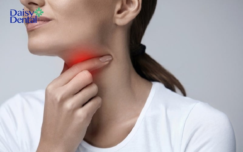 Đau rát họng dữ dội là một trong các triệu chứng thường thấy của bệnh lý này