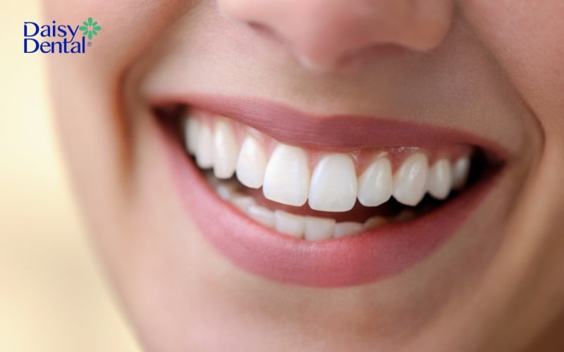 Răng vĩnh viễn sẽ dần xuất hiện, thay thế răng sữa trên cung hàm