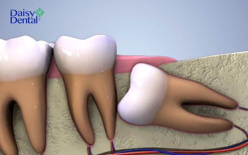 Bên dưới chân răng có nhiều dây thần kinh quan trọng