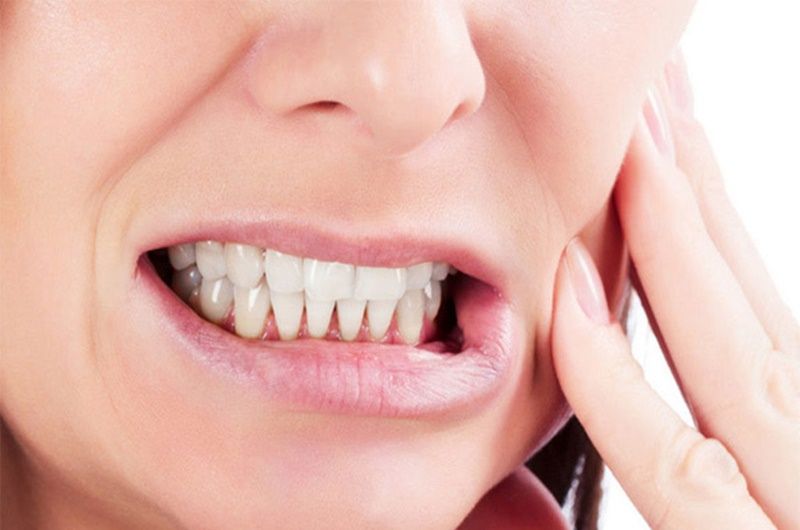 Nghiến răng là một trong những nguyên nhân gây nên bệnh lý này.