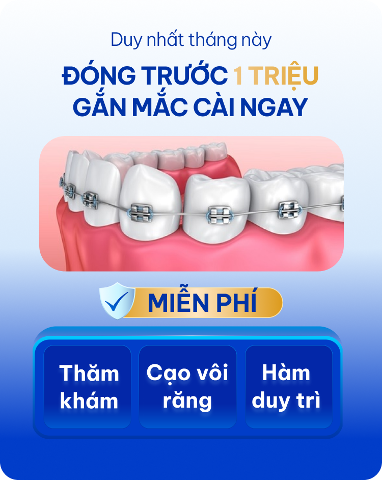 Niềng răng