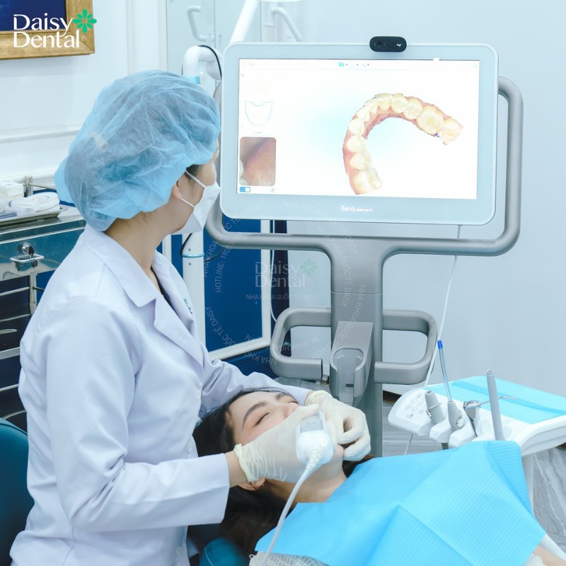 Cô bạn sinh viên “lên đời nhan sắc” nhờ chỉnh nha, khắc phục khuyết điểm răng khấp khểnh