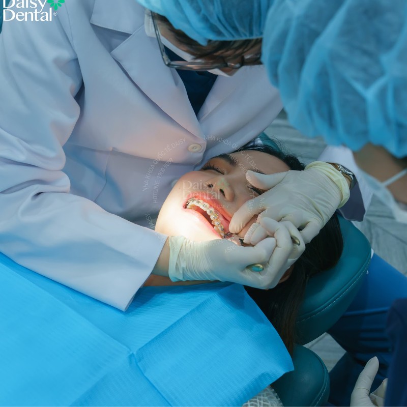 Cô bạn sinh viên “lên đời nhan sắc” nhờ chỉnh nha, khắc phục khuyết điểm răng khấp khểnh