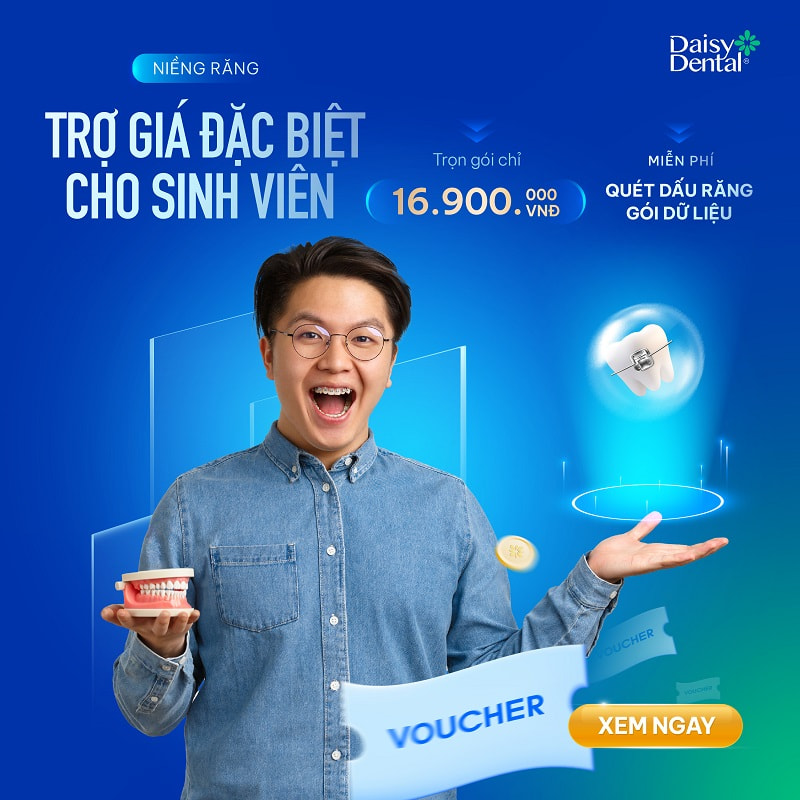 Chương trình niềng răng trợ giá đặc biệt dành cho sinh viên tại Nha khoa Quốc tế DAISY.