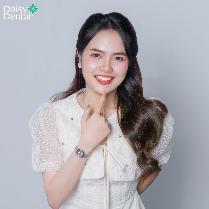 Sự thay đổi ngoạn mục trước và sau khi tháo niềng răng của các bạn sinh viên tại DAISY DENTAL