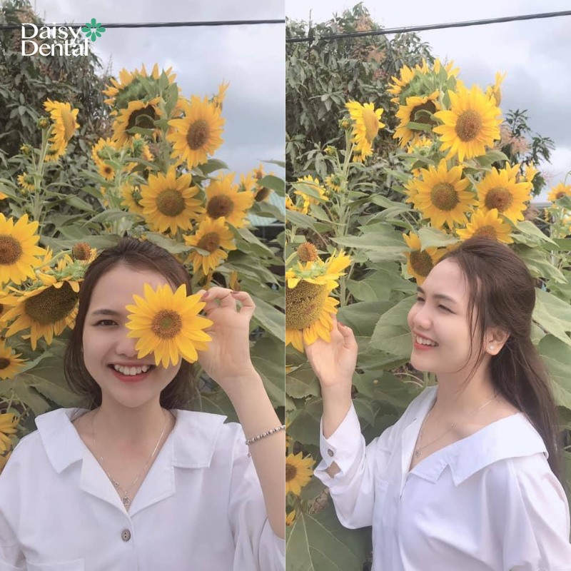 Sự thay đổi ngoạn mục trước và sau khi tháo niềng răng của các bạn sinh viên tại DAISY DENTAL