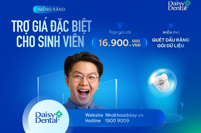 Niềng răng sinh viên