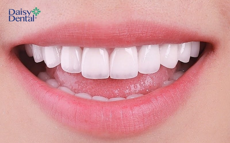 Chiều dài trung bình răng của nữ giới sẽ rơi vào khoảng 12,63 ± 1,50mm