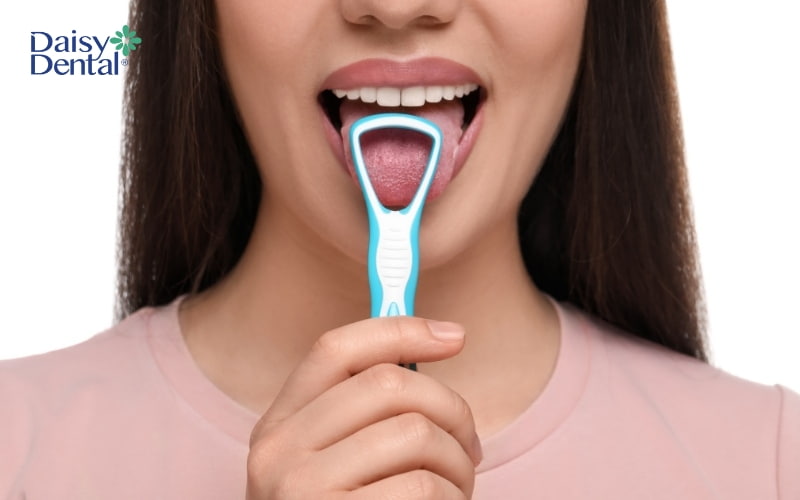 Loại bỏ vi khuẩn gây mùi bám ở lưỡi có thể cải thiện tình trạng hôi miệng