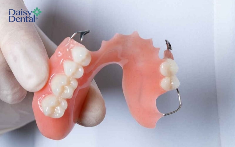Hàm khung liên kết được sử dụng trong một số trường hợp mất một hoặc nhiều răng