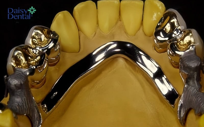 Hàm khung liên kết attachment