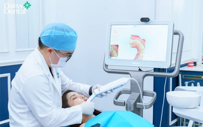 niềng răng cho răng khấp khểnh
