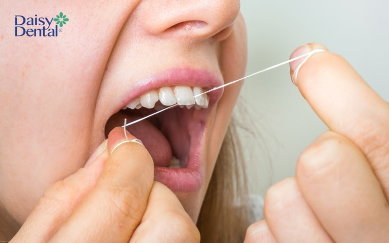 Chỉ nha khoa giúp loại bỏ vụn thức ăn, mảng bám ở kẽ răng hiệu quả