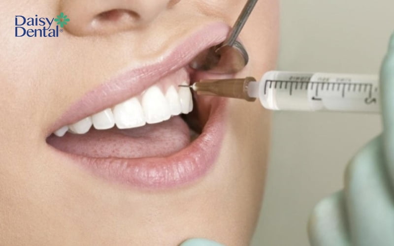 Thuốc sẽ giúp người bệnh không cảm thấy đau nhức khi nhổ răng