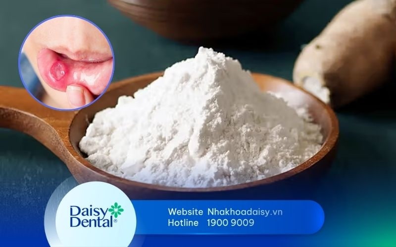 Cách chữa nhiệt miệng bằng bột sắn dây