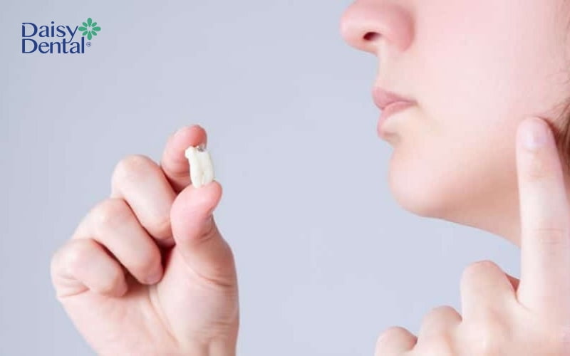 Vết đen trên răng xuất hiện ở răng khôn sẽ được bác sĩ khuyên nhổ bỏ