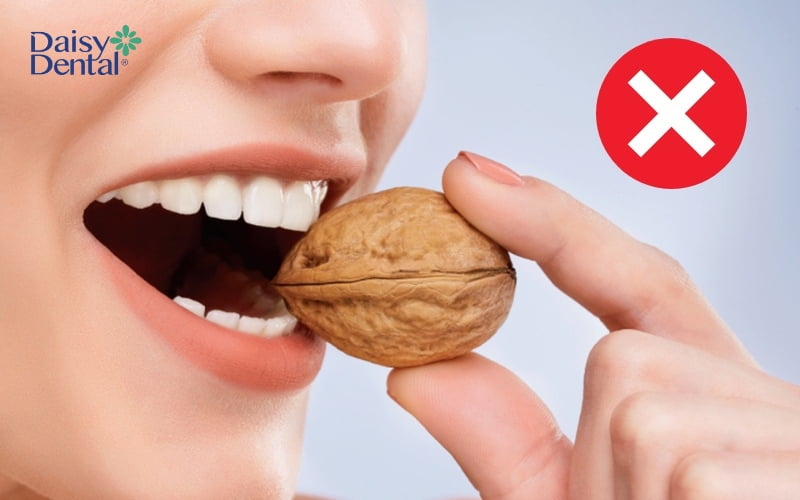 Không dùng răng vừa trám cắn xé mạnh hoặc nhai thức ăn cứng, dai