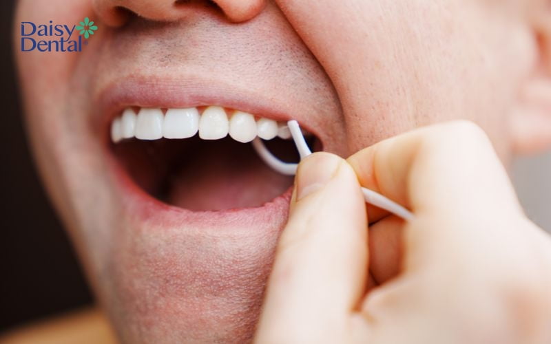 Xỉa răng sau khi ăn là một thói quen giúp làm sạch răng hiệu quả