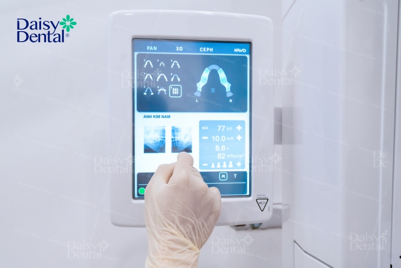 Công nghệ chẩn đoán hình ảnh CT KaVo OP 3D Progiúp tái tạo hình ảnh 3D chi tiết, hỗ trợ bác sĩ lên kế hoạch điều trị hiệu quả.